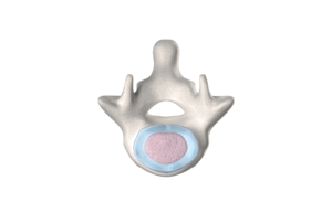 annulus-fibrosus-nedir