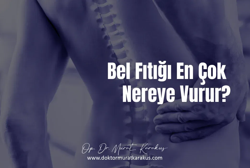 bel-fitigi-en-cok-nereye-vurur
