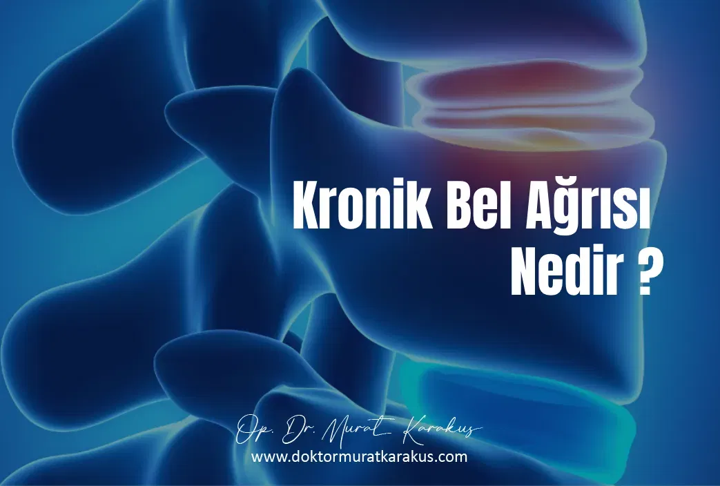 kronik-bel-agrisi-nedir
