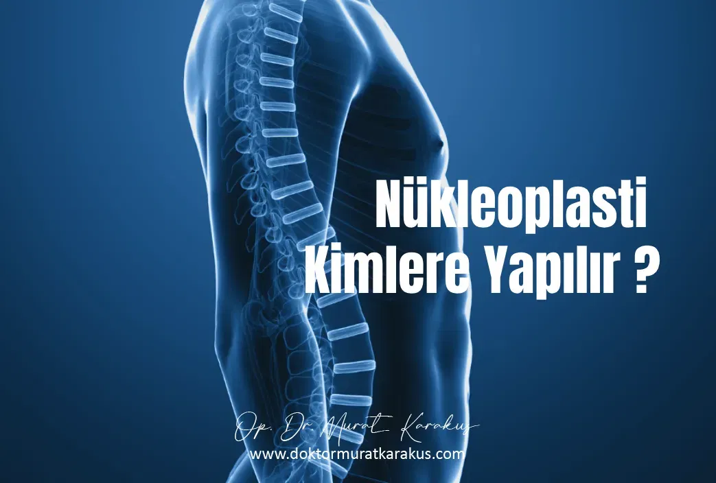 nukleoplasti
