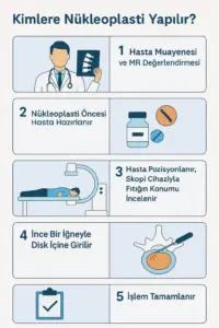 nukleoplasti-tedavisi